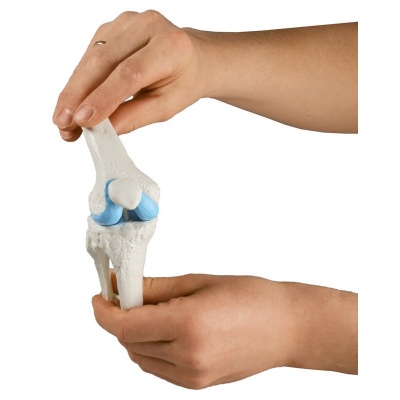 Knee Implant Model
